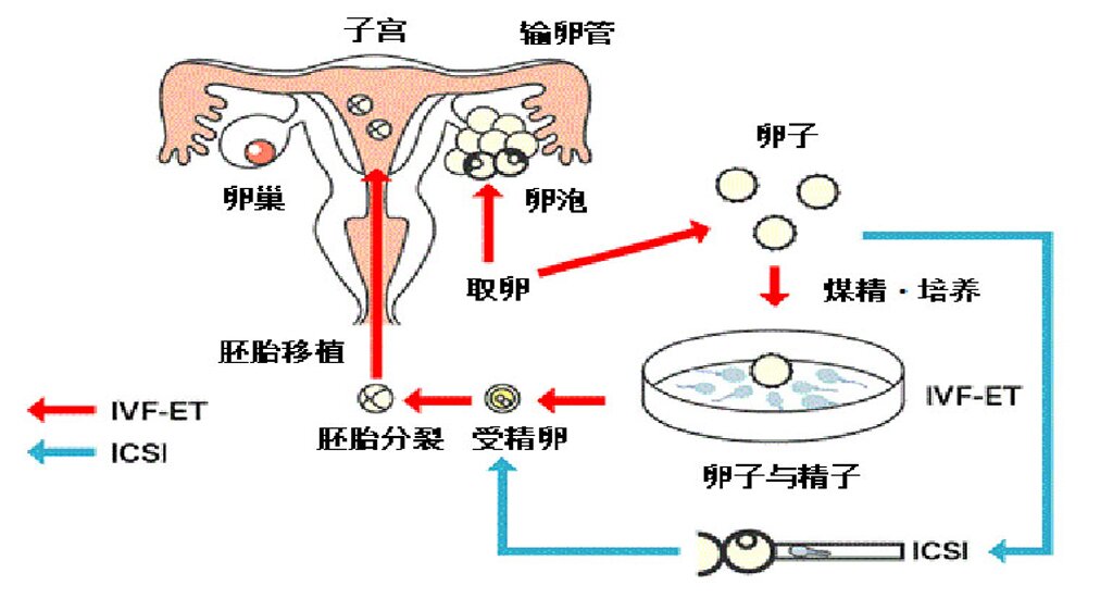 上海代孕机构：我的“幸孕”不是“奇迹”